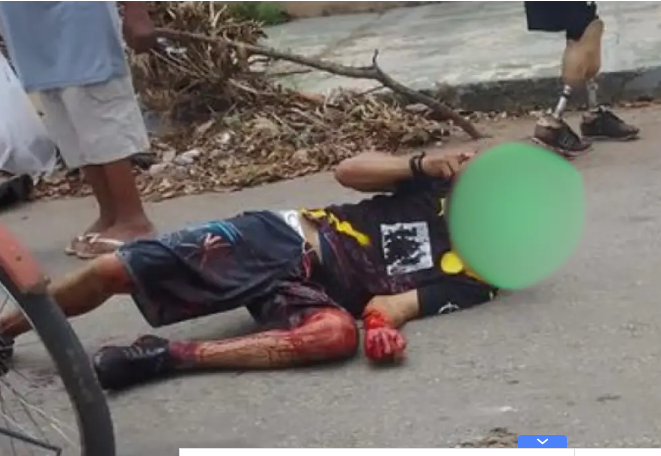 Dona Fiica: Morador reage a agressões e atinge agressor com golpes de podão