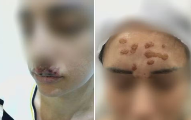 Imagens mostram ferimentos em vítimas de procedimentos, Goiás — Foto: Reprodução/TV Anhanguera
